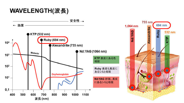 ルビーレーザーとは
